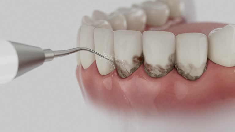 Reliable Dental Implants contractor in Cortland, OH by Smile Center Dentistry